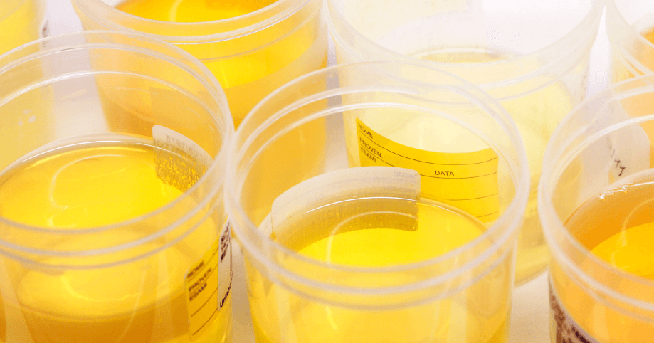 drug test cheating; substitute sample